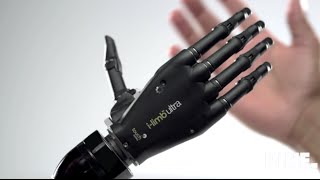 Top 5 bionic arm [upl. by Fulvi]