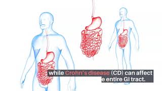 Life Science DSS Induced Colitis MP Biomedicals  Immunology [upl. by Alul242]