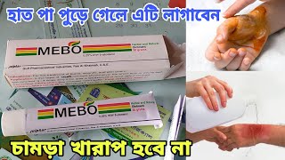 MEBO Ointments যে সব মা বনেরা রান্নাঘরে হাত পা পুড়ে গিয়ে থাকেন এটি লাগাবেন চামড়া খারাপ হবে না। [upl. by Enyaz353]