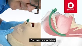 Nasopharyngeal Airway inbrengen  Doczero Elearning [upl. by Jolenta]