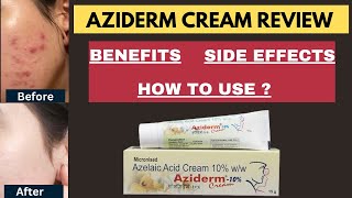 Aziderm cream review Aziderm cream Benefits Uses amp Side effects  Aziderm 10 Gel  Azelaic acid [upl. by Spratt]