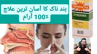 Xynosine nasal spray uses in Urdu  Nasal blockage easy solution [upl. by Icaj470]