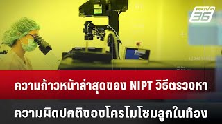 ความก้าวหน้าล่าสุดของ NIPT วิธีตรวจหาความผิดปกติของโครโมโซมลูกในท้อง  เข้มข่าวค่ำ  20 กค 67 [upl. by Lucho]