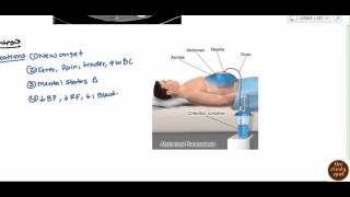 Ascites for USMLE Step 2 [upl. by Ygief]