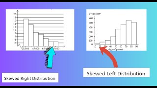 Skewed to the Left or Skewed to the Right [upl. by Corsetti]