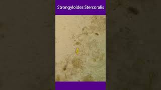 Strongyloides stercoralis [upl. by Ahsia]