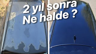 Güneş yanığı onarımı sonrası son durum  Sohbet Havasında [upl. by God]