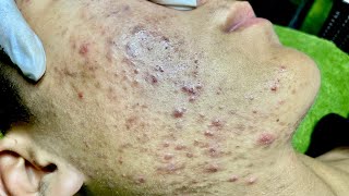 Satisfying video with Chung Vo Spa  374 [upl. by Aracot]