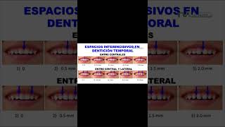 ESPACIOS INTERINCISIVOS EN DIENTES TEMPORALES dientestemporales dientesleche denticióninfantil [upl. by Finella]