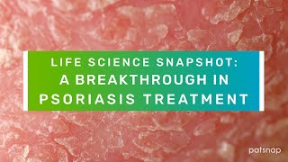 Life Science Snapshot A Breakthrough in Psoriasis Treatment [upl. by Debora]