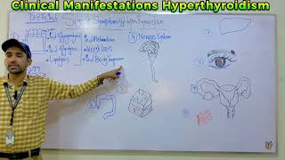 Clinical Manifestations of Hyperthyroidism part i [upl. by Juliet367]