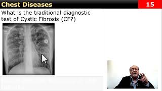 Clinical Case Chest Quick question internalmedicine cme usmle محاضراتباطنة [upl. by Thomson]