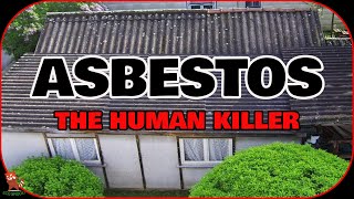 ASBESTOSIS  WHY ASBESTOS STILL TORTURING PEOPLE [upl. by Batchelor]