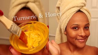 I TRIED TURMERIC FACE MASKS FOR 5 DAYS  RESULTS  ACNE PRONE SKIN [upl. by Ten]