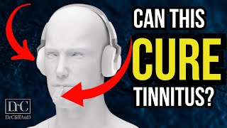 New Tinnitus Treatment Update  Bimodal Neuromodulation from Lenire [upl. by Elrem987]