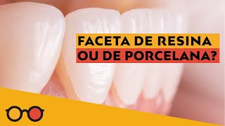 QUANTO CUSTA LENTES DE CONTATO DENTAL DE RESINA São mais baratas VOU FALAR O PREÇO [upl. by Zacek979]