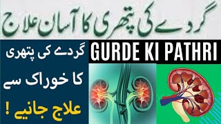 Gurde Ki Pathri Ka Ilaj  A Complete Guide [upl. by Airoled]