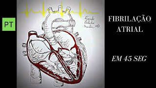 Arritmias Animação cardíaca e ECG  Fibrilação Atrial Shorts [upl. by Neala893]