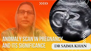 Anomaly scan in pregnancy and its significance  Dr Saima Khan [upl. by Macintyre238]