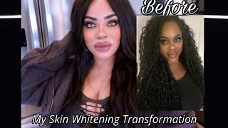 My Extreme Skin Whitening Transformation 2024 [upl. by Namus]