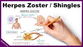 Herpes ZosterShingles Symptoms Diagnosis Treatment [upl. by Ahseela]