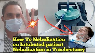 Nebulization on ventilator  how to give nebulization via tracheostomy  How to Nebulize ETT [upl. by Imat]