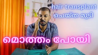 Hair transplantation after 20 days  ഇത്ര ദിവസം കൊണ്ട് മുടിക്ക് വന്ന മാറ്റം  safvan pullara [upl. by Yenots410]