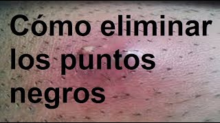 Cómo eliminar los puntos negros [upl. by Amorette]