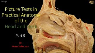 Picture tests in head and neck anatomy 9 [upl. by Aneleve]