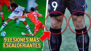 Las 9 LESIONES MÁS ESCALOFRIANTES En Un Campo De Futbol 💀⚽ [upl. by Selfridge]