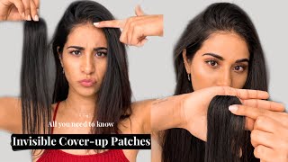 Cover up Patches  Cover Up Your Bald Spot With A Snap Clipin Extensions  Hair Thinning Solution [upl. by Latsyrcal698]