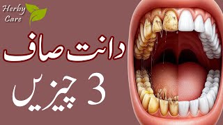 Top 3 Effective Home Remedies to Remove Plaque and Tarter [upl. by Annaoy]