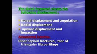 Lecture8ORTHOColles fracture [upl. by Yenruoc]