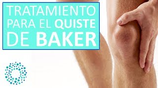 TRATAMIENTO para el QUISTE DE BAKER [upl. by Siol]