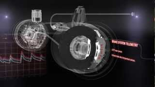 How Brembo Brake System works in F1 [upl. by Niras253]