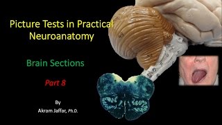 Picture Test in Neuroanatomy Brain Sections 8 [upl. by Ruelu]