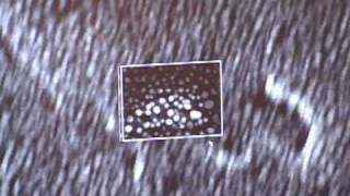 Scanning Electron Microscope Pt 4 of 6 [upl. by Annekim]