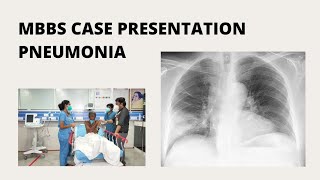 MBBS Case Presentation  Pneumonia [upl. by Aniaz]