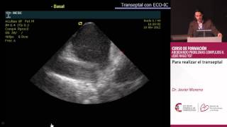 Para realizar el transeptal Dr Javier Moreno [upl. by Maryanna]