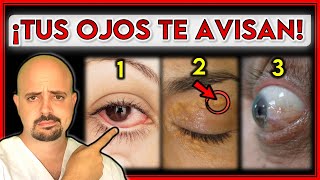 7 SEÑALES en tus OJOS que indican un PROBLEMA de SALUD  ¡NO los IGNORES [upl. by Darryl694]