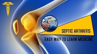 Septic Arthritis  DefinitionCauseSignsSymptomsDiagnosis [upl. by Clementine]