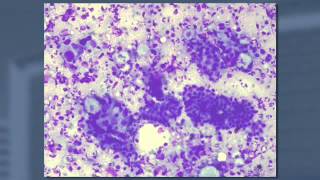 What an Endosonographer Should Know About Cytopathology [upl. by Erialb48]