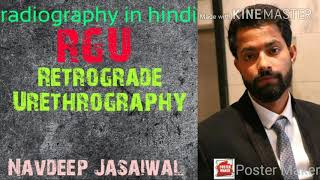 Retrograde urethrography RGU  radiography in hindi [upl. by Ariad]