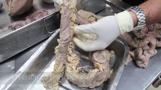 Anatomy Dissection of Large amp Small Intestine [upl. by Anatlus]