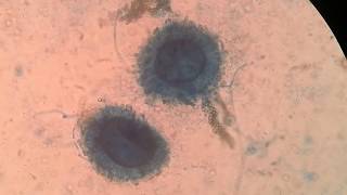 Sporangium and Sporangiospores [upl. by Ross]