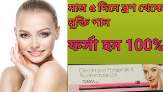 Clinsol gel use in bangla ফর্সা হন 100 Clinsol gel full review bangla [upl. by Niltac]