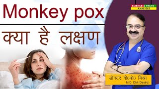 Monkey pox के क्या है लक्षण  MONKEY POX VIRUS FOR YOUR AWARENESS THE SYMPTOMS [upl. by Yecam]