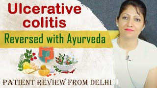 Ulcerative colitis treatment in Ayurveda  Patient Review from Delhi [upl. by Haseefan]