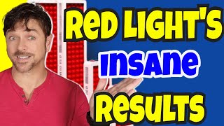 How Red Light Skin Therapy Works AntiAging Acne Hair Loss  Chris Gibson [upl. by Anual567]