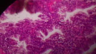 secretory phase of endometrium [upl. by Yelda]